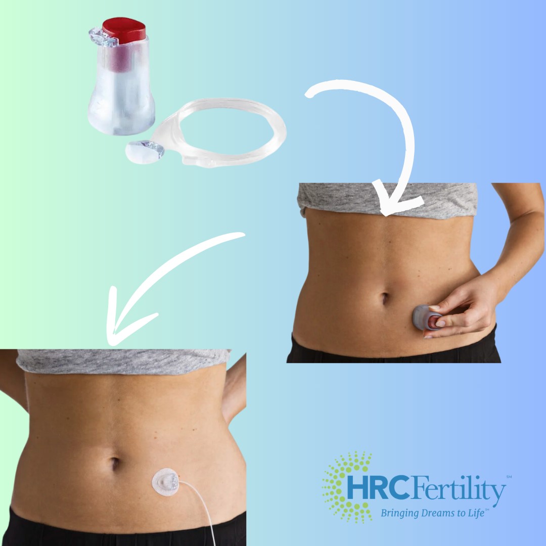 Fertility Graphic